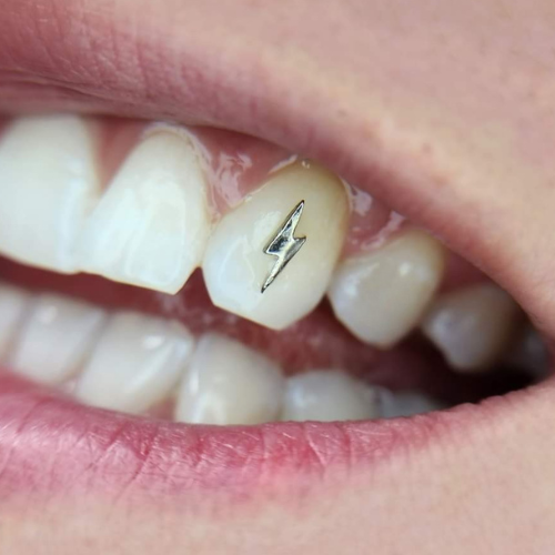 Tooth Gem Appointment