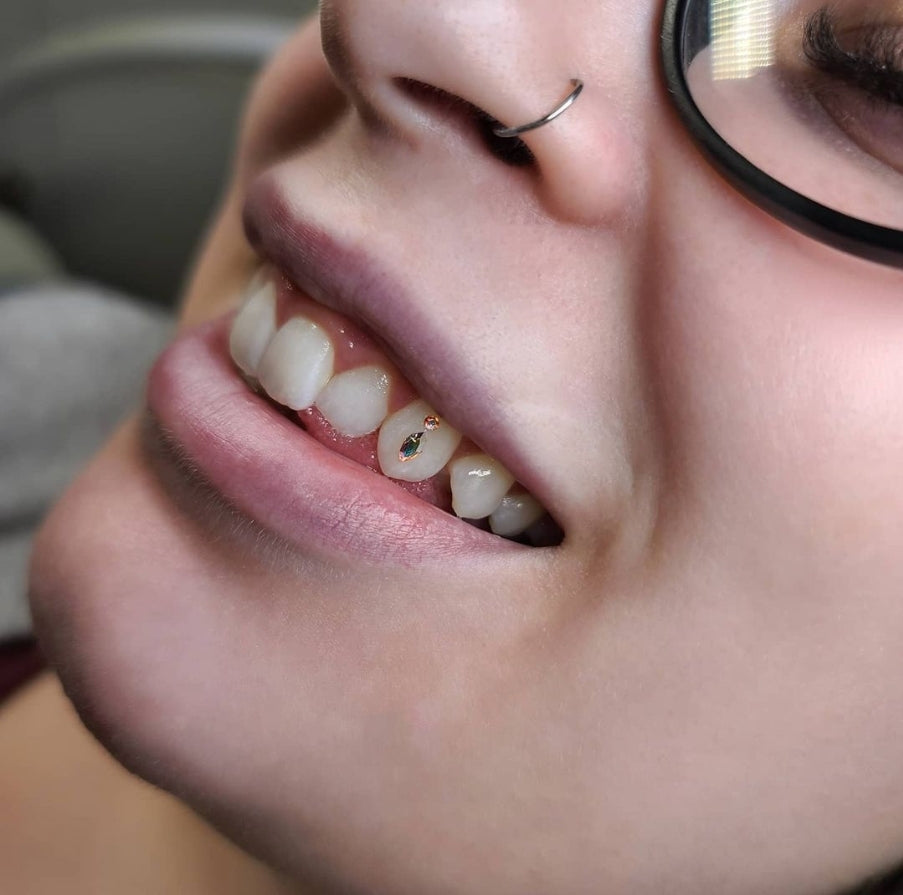 Tooth Gem Appointment