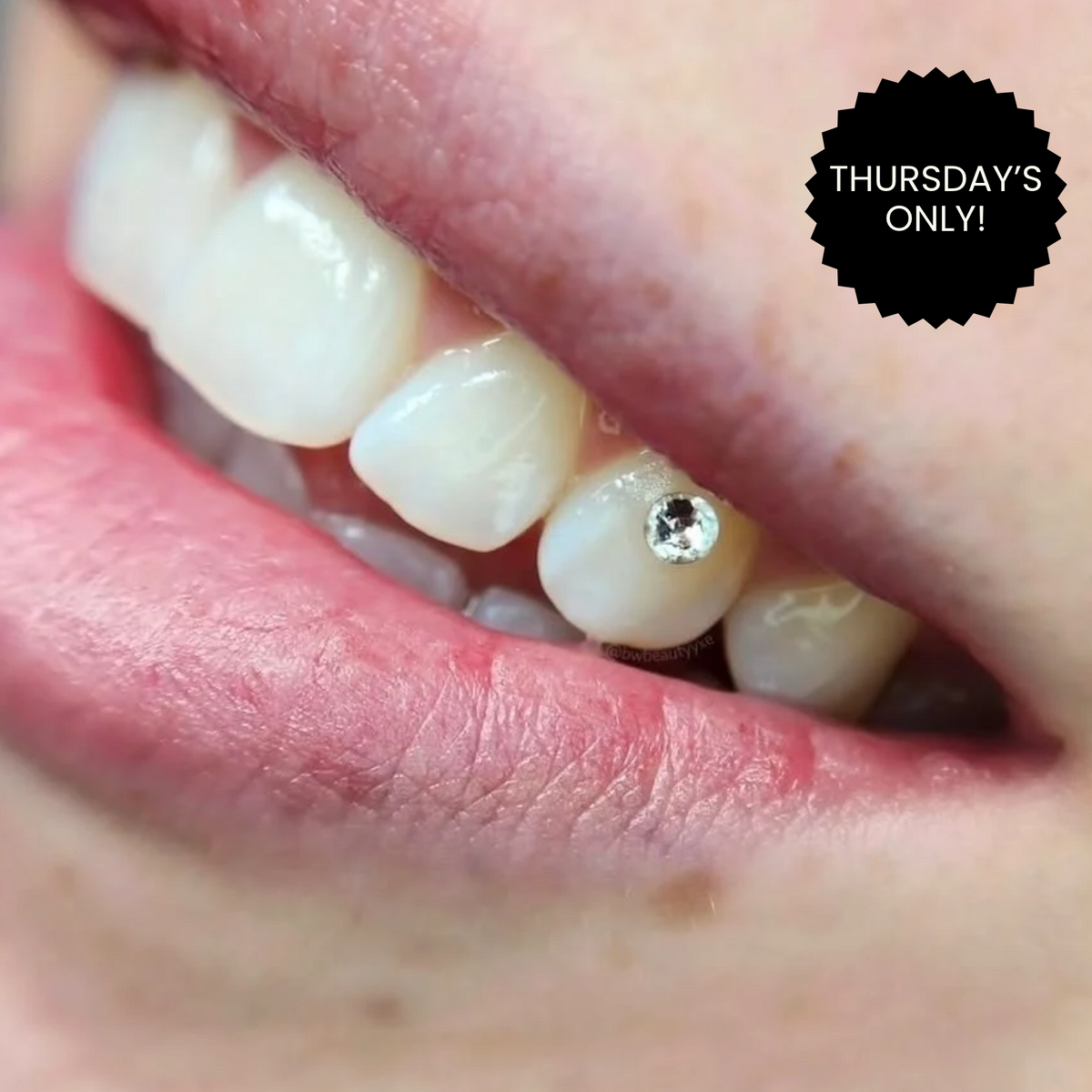 Thursday Glow Up - Tooth Gem