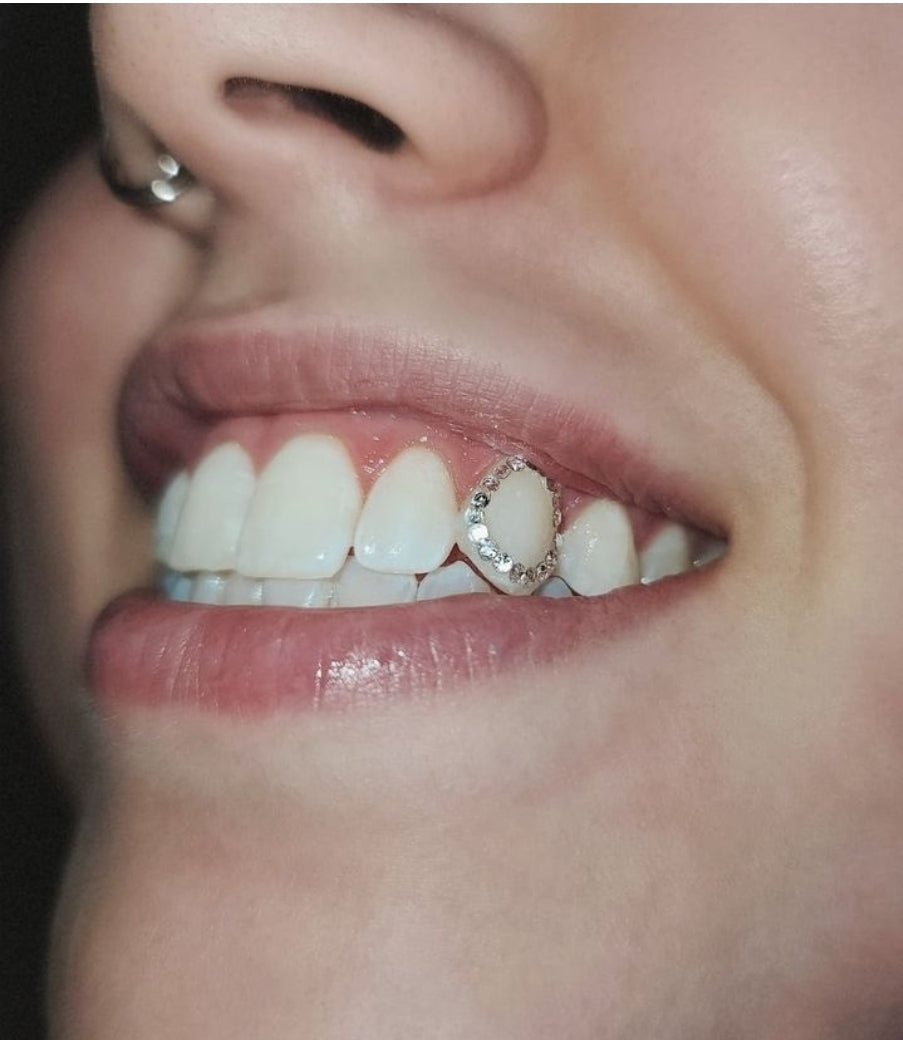 Tooth Gem Appointment